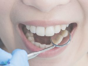 Consulta Dental en Cartagena