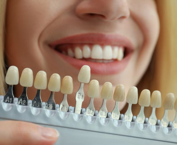 Odontología Estética